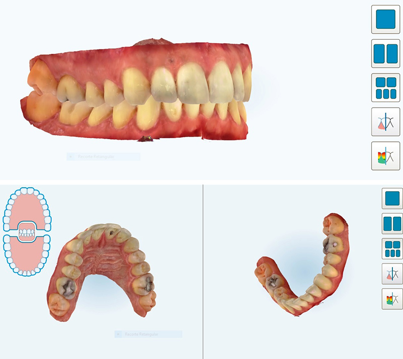 Análise 3D das estruturas orais