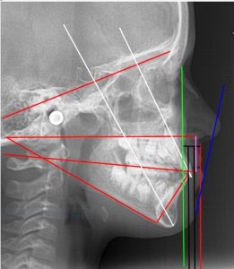 Individualized geometric analysis of facial harmony ®