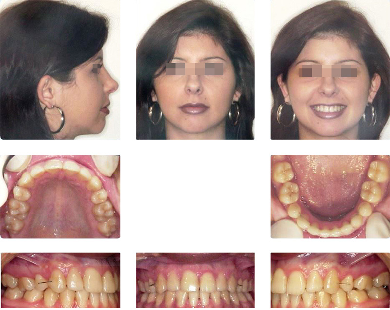 Estudo fotográfico extra e intraoral