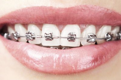 Orthodontics<br>Orthognatic Surgery