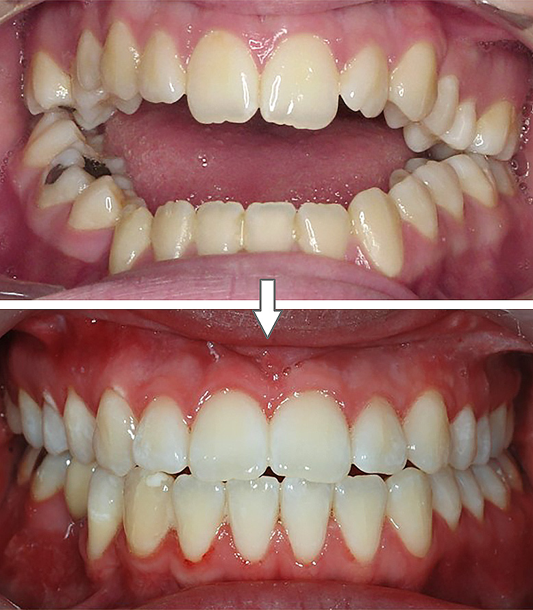 Ortodontia / Cirurgia ortognática - Ortopóvoa